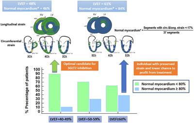 <mark class="highlighted">SGLT2 Inhibition</mark> in HFpEF. Do We Need More Quantitative and Load Independent Metrics to Understand the Results of the EMPEROR-Preserved Trial?